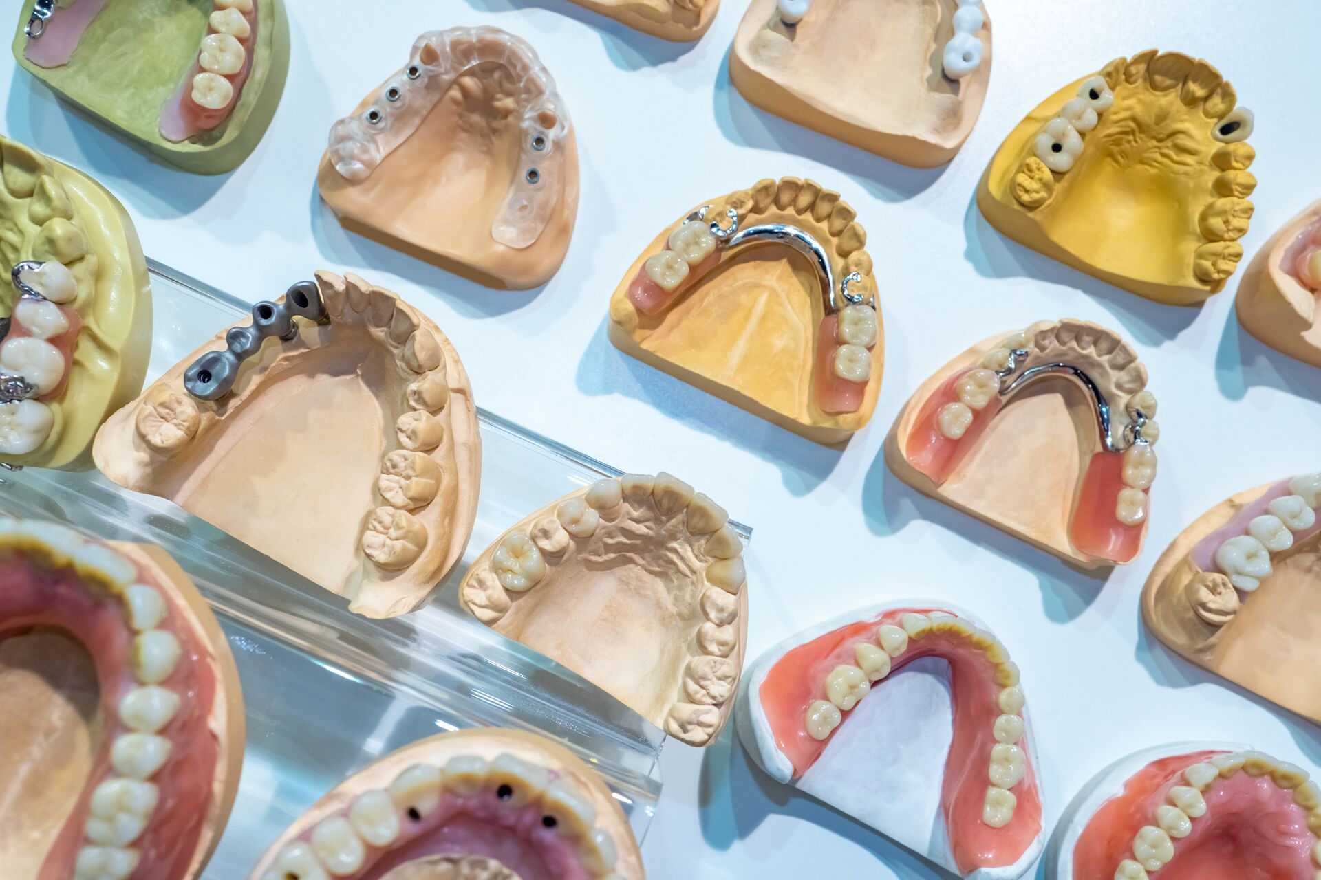 Zahnarztpraxis für Zahnersatz in Dresden
